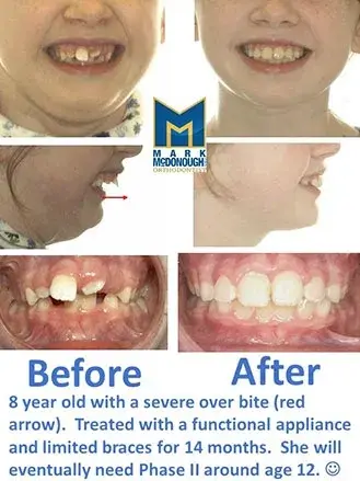 Dentofacial Orthopedics