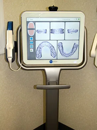 iTero® Scanner
